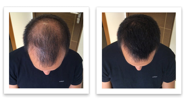Caboki Hair Fiber, Trial Size