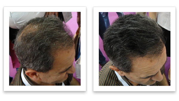 Caboki Hair Fiber, Trial Size