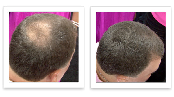 Caboki Hair Fiber, Trial Size