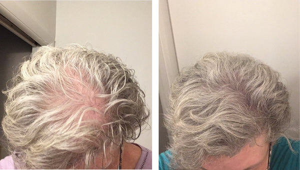 Caboki Hair Fiber, All-Natural Hair Loss Concealer (30 Gram, 90-day supply)