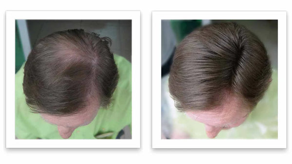 Caboki Hair Fiber, Trial Size