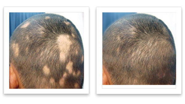 Caboki 10X Hair Powder - Trial Size