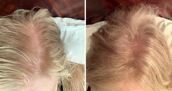 Caboki Hair Fiber, Trial Size