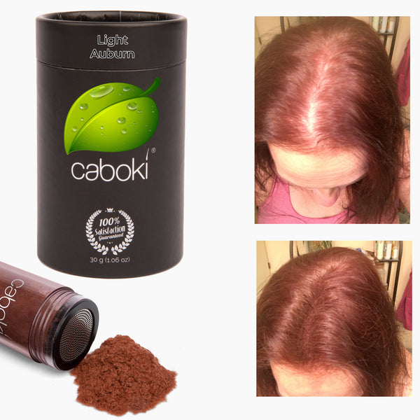 Caboki Hair Fiber, All-Natural Hair Loss Concealer (30 Gram, 90-day supply)