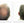 Before and after image of a man with short gray hair, a bald spot on his crown, and thin hair on his mid-scalp region